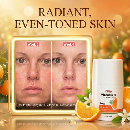 ITZZO® Vitamin C Face Serum