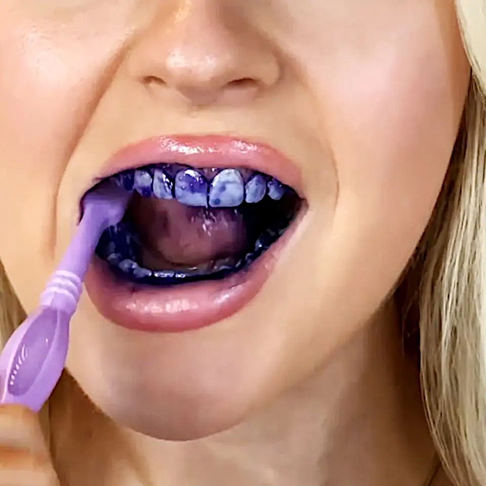 ITZZO Color Corrector Tooth Stain Removal | Teeth Whitening Booster | Purple Toothpaste |  Enamel-Safe - Goshop2gain, LLC